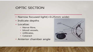 SLIT LAMP BIOMICROSCOPY EXAMINATION.pptx