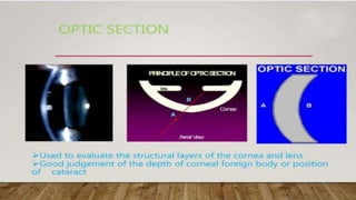 SLIT LAMP BIOMICROSCOPY EXAMINATION.pptx