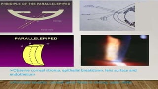 SLIT LAMP BIOMICROSCOPY EXAMINATION.pptx