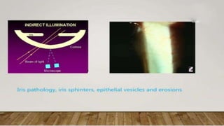 SLIT LAMP BIOMICROSCOPY EXAMINATION.pptx