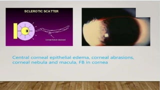 SLIT LAMP BIOMICROSCOPY EXAMINATION.pptx