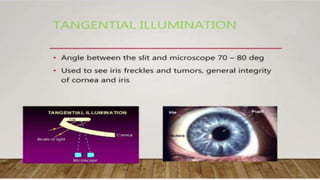 SLIT LAMP BIOMICROSCOPY EXAMINATION.pptx