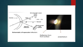 Slit Slide Slit Lamp Biomicroscopy by resident .pptx