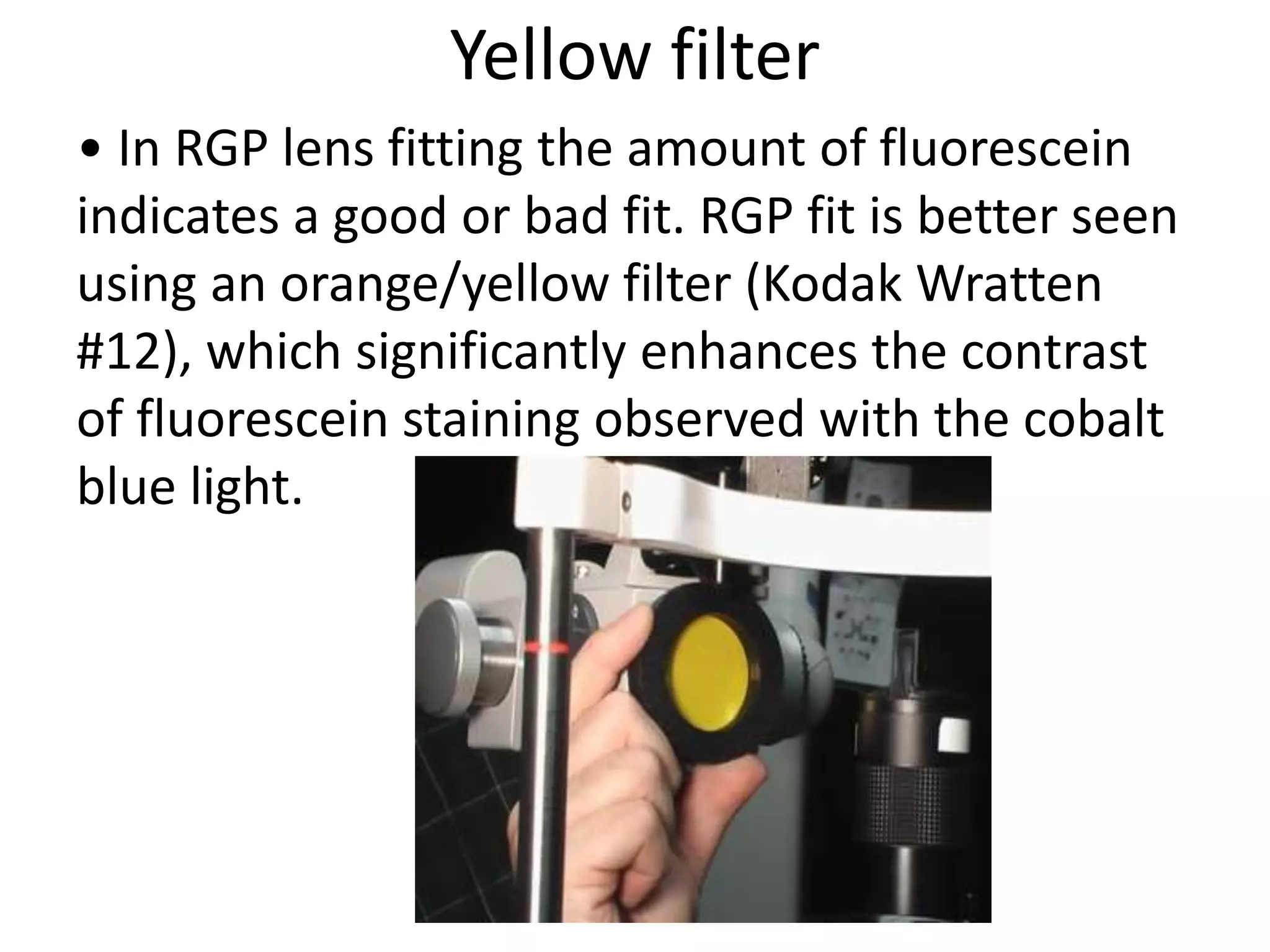 Slit lamp evaluation | PPTX