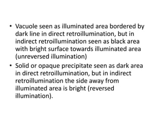 • Vacuole seen as illuminated area bordered by
dark line in direct retroillumination, but in
indirect retroillumination seen as black area
with bright surface towards illuminated area
(unreversed illumination)
• Solid or opaque precipitate seen as dark area
in direct retroillumination, but in indirect
retroillumination the side away from
illuminated area is bright (reversed
illumination).
 