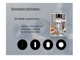 Slit Slide Slit lamp evaluation | PPTX