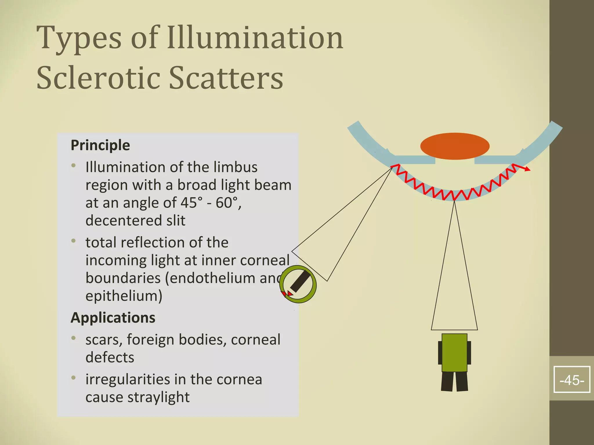 Slit lamp examination | PPT