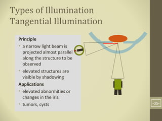 Slit lamp examination | PPT