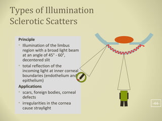 Types of Illumination
Sclerotic Scatters
Principle
• Illumination of the limbus
region with a broad light beam
at an angle of 45° - 60°,
decentered slit
• total reflection of the
incoming light at inner corneal
boundaries (endothelium and
epithelium)
Applications
• scars, foreign bodies, corneal
defects
• irregularities in the cornea
cause straylight
-44-
 