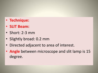 Slit Slide Slit lamp examination lecture | PPTX