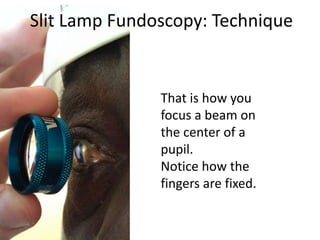 That is how you
focus a beam on
the center of a
pupil.
Notice how the
fingers are fixed.
Slit Lamp Fundoscopy: Technique
 