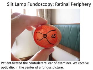 Slit Lamp Fundoscopy: Retinal Periphery
Patient fixated the contralateral ear of examiner. We receive
optic disc in the center of a fundus picture.
 