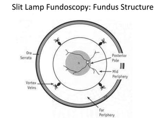 Slit Lamp Fundoscopy: Fundus Structure
 