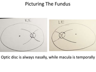Picturing The Fundus
Optic disc is always nasally, while macula is temporally
 