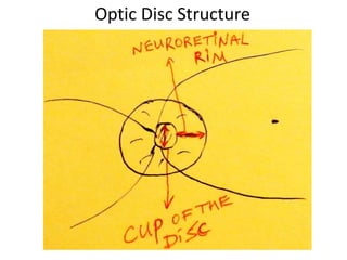 Optic Disc Structure
 