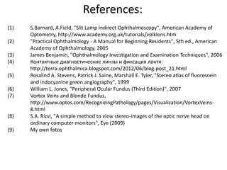 References:
(1) S.Barnard, A.Field, "Slit Lamp Indirect Ophthalmoscopy", American Academy of
Optometry, http://www.academy.org.uk/tutorials/volklens.htm
(2) "Practical Ophthalmology - A Manual for Beginning Residents", 5th ed., American
Academy of Ophthalmology, 2005
(3) James Benjamin, "Ophthalmology Investigation and Examination Techniques", 2006
(4) Контактные диагностические линзы и фиксация локтя:
http://terra-ophthalmica.blogspot.com/2012/06/blog-post_21.html
(5) Rosalind A. Stevens, Patrick J. Saine, Marshall E. Tyler, "Stereo atlas of fluorescein
and indocyanine green angiography", 1999
(6) William L. Jones, "Peripheral Ocular Fundus (Third Edition)", 2007
(7) Vortex Veins and Blonde Fundus,
http://www.optos.com/RecognizingPathology/pages/Visualization/VortexVeins-
8.html
(8) S.A. Rizvi, "A simple method to view stereo-images of the optic nerve head on
ordinary computer monitors", Eye (2009)
(9) My own fotos
 