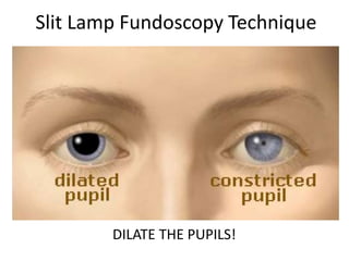 Slit Lamp Fundoscopy Technique
DILATE THE PUPILS!
 