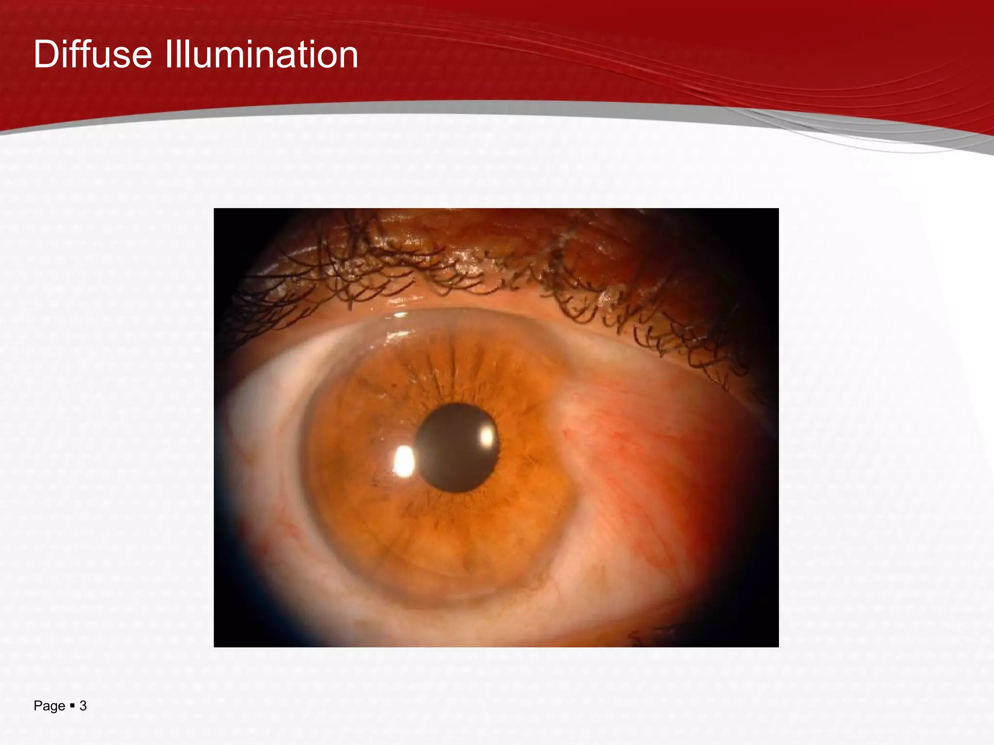 Transvestit porno YouTube