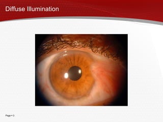 Diffuse Illumination 