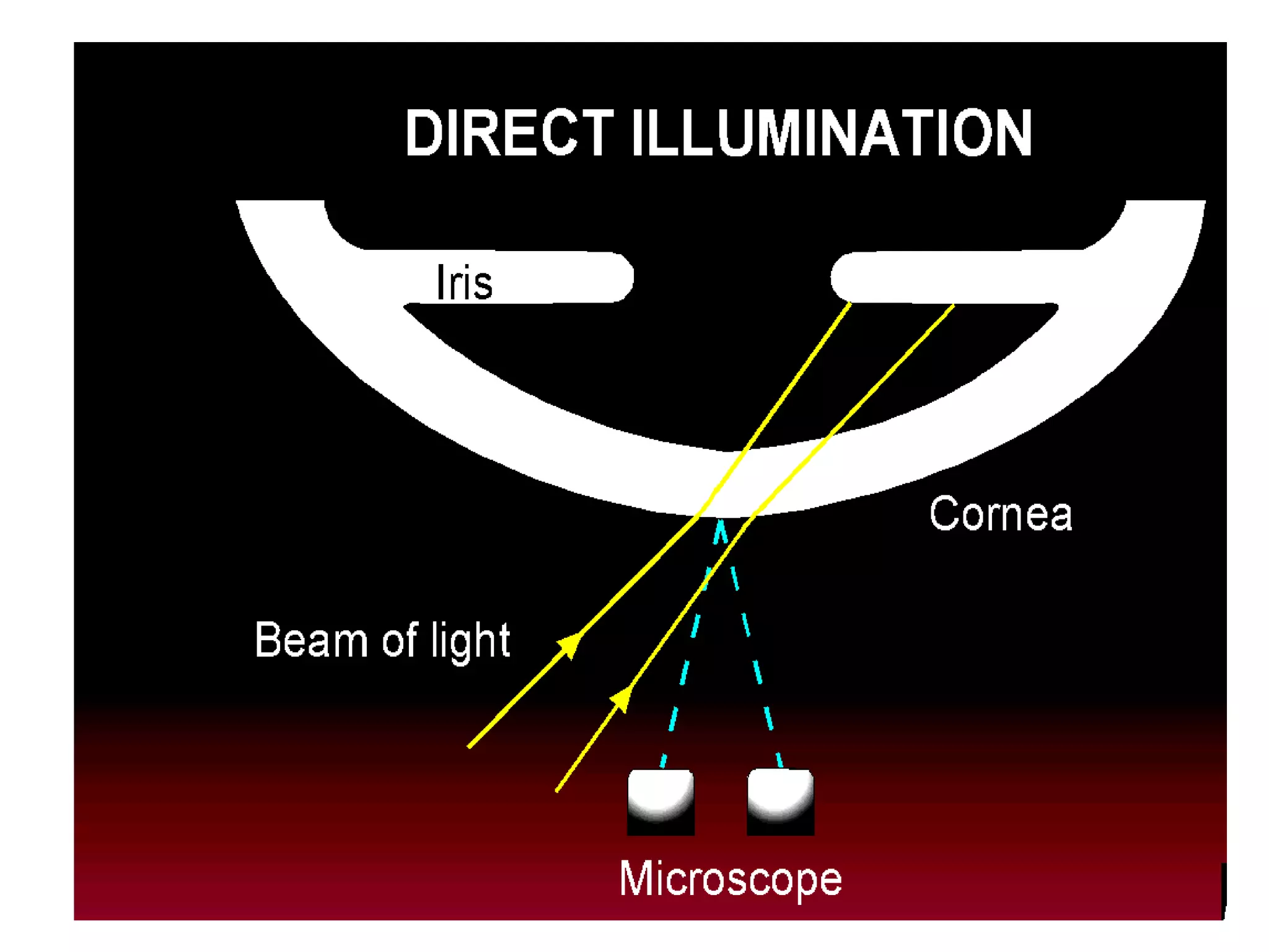 Slit lamp techniques.pptx