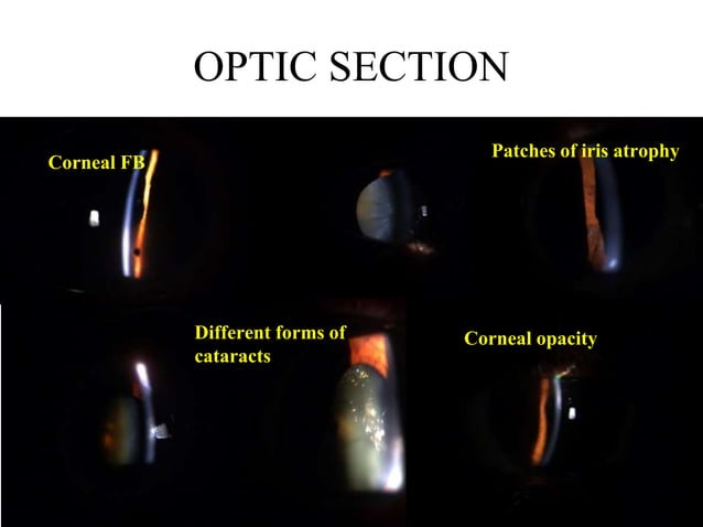 Slit Slide Slit lamp techniques.pptx