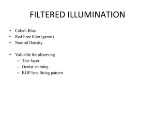 FILTERED ILLUMINATION
• Cobalt Blue
• Red Free filter (green)
• Neutral Density
• Valuable for observing
– Tear layer
– Ocular staining
– RGP lens fitting pattern
 