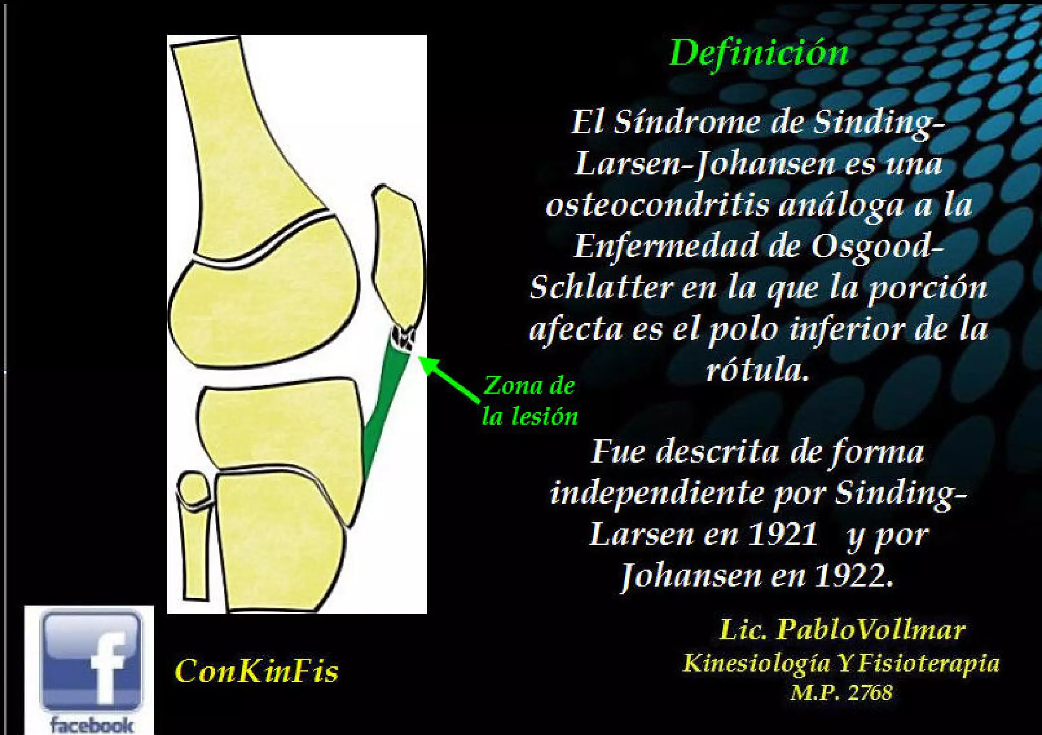 Sindrome De Sinding Larsen Johansson Pdf