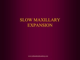 SLOW MAXILLARY
EXPANSION
www.indiandentalacademy.com
 