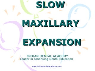 SLOWSLOW
MAXILLARYMAXILLARY
EXPANSIONEXPANSION
INDIAN DENTAL ACADEMY
Leader in continuing Dental Education
www.indiandentalacademy.com
 