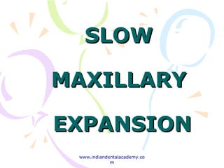 SLOWSLOW
MAXILLARYMAXILLARY
EXPANSIONEXPANSION
www.indiandentalacademy.co
m
 