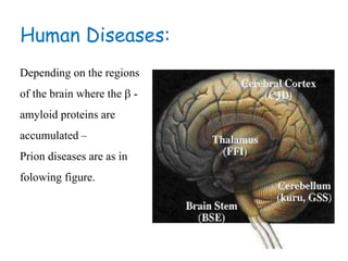 Human Diseases:
Depending on the regions
of the brain where the  -
amyloid proteins are
accumulated –
Prion diseases are as in
folowing figure.
 
