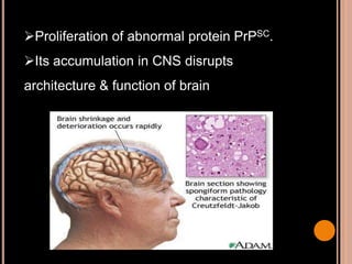 Proliferation of abnormal protein PrPSC.
Its accumulation in CNS disrupts
architecture & function of brain
 