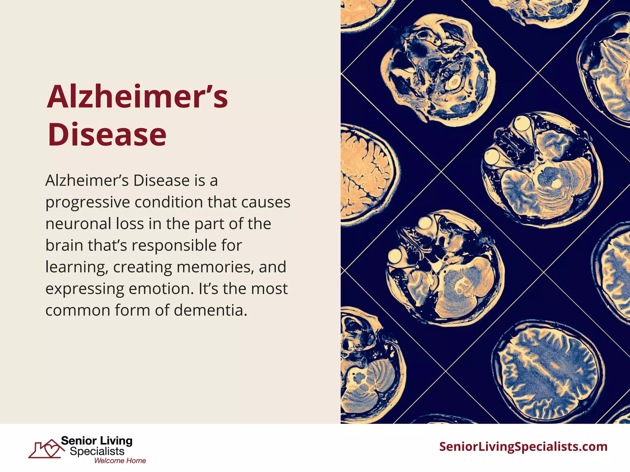 Different Types of Dementia | PDF