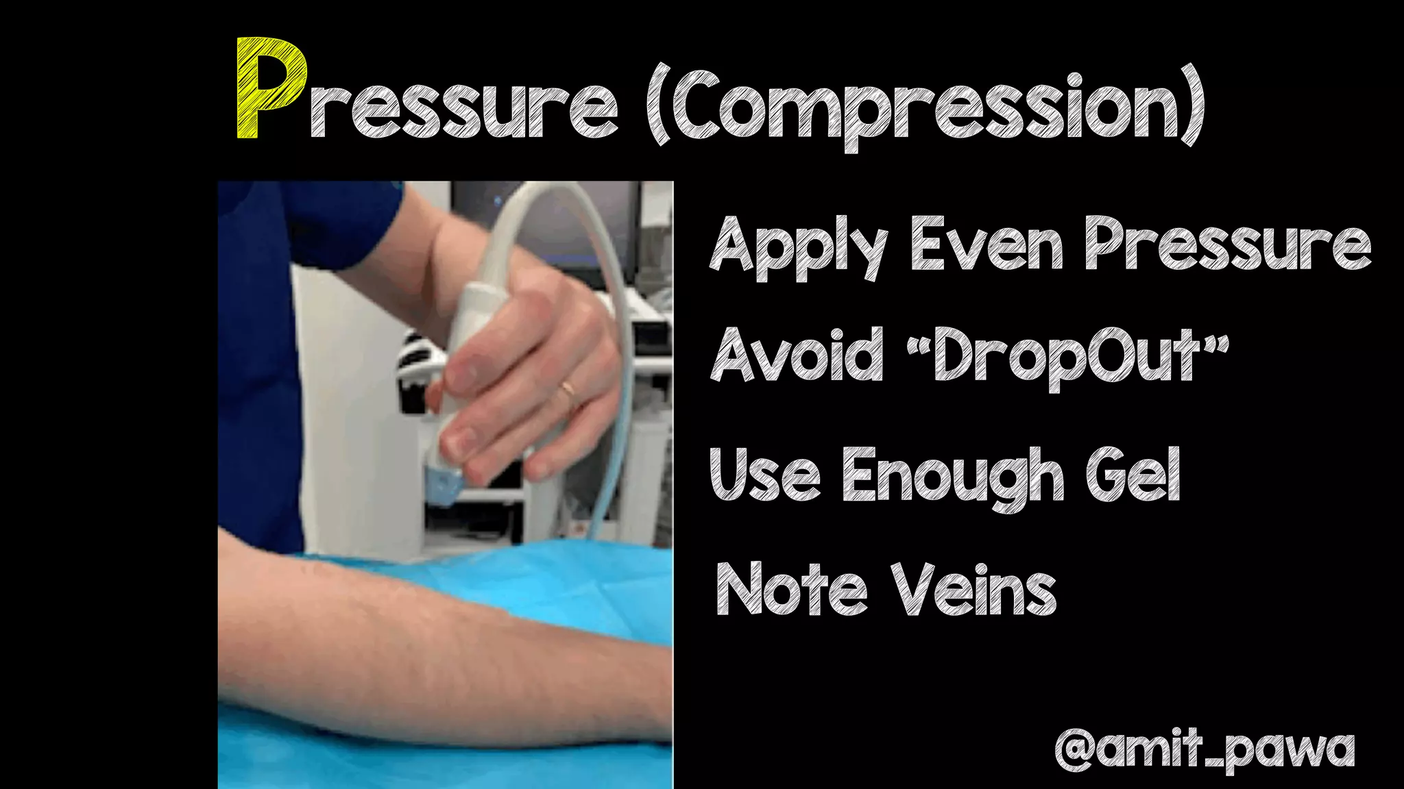 Fundamentals of Regional Anaesthesia & Plan A Blocks | PDF