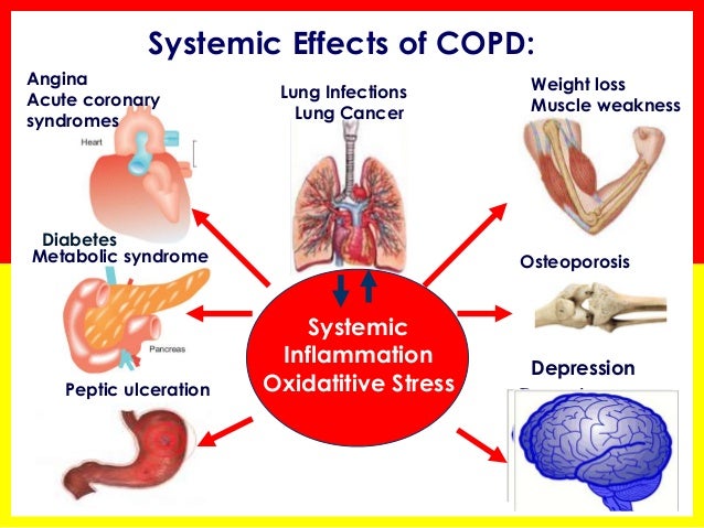 What is chronic bronchiectasis?