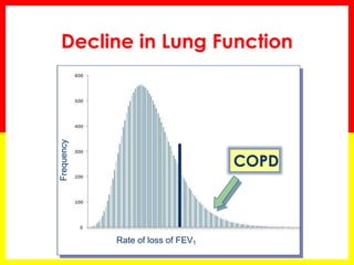 Decline in Lung Function
Frequency
Rate of loss of FEV1
COPD
 