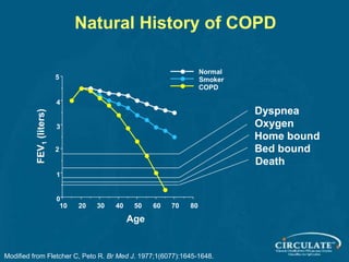 Natural History of COPD
8070605040302010
0
1
2
3
4
5
Normal
Smoker
COPD
Age
FEV1(liters)
Dyspnea
Oxygen
Home bound
Bed bound
Death
Modified from Fletcher C, Peto R. Br Med J. 1977;1(6077):1645-1648.
 