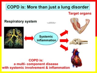 COPD is:
a multi- component disease
with systemic involvement & inflammation
Respiratory system
Systemic
inflammation
Target organs
QuickTime™ and a
TIFF (Uncompressed) decompressor
are needed to see this picture.
COPD is: More than just a lung disorder
 