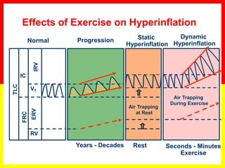 Effects of Exercise on Hyperinflation
VT
IRVERV
IC
RV
Normal
Years - Decades
Progression
Rest
Static
Hyperinflation
Air Trapping
at Rest
Seconds - Minutes
Exercise
Dynamic
Hyperinflation
Air Trapping
During Exercise
 