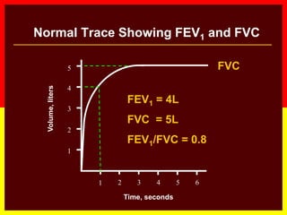 Normal Trace Showing FEV1 and FVC
1 2 3 4 5 6
1
2
3
4
Volume,liters
Time, seconds
FVC5
1
FEV1 = 4L
FVC = 5L
FEV1/FVC = 0.8
 