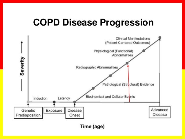 Copd Progression Chart