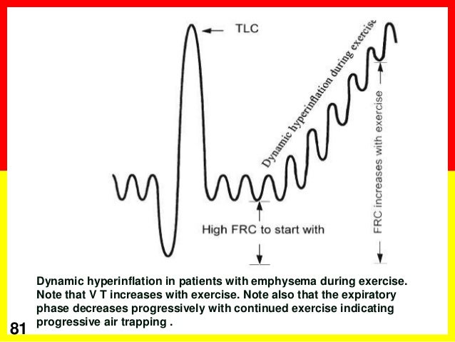 COPD back to basis