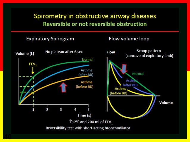 Asthma-COPD Overlap Syndrome (ACOS) | PPTX | Lung and Respiratory ...