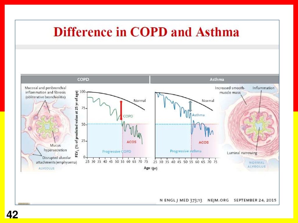 Copd Overlap Syndromes: Asthma And Beyond – BERYSV