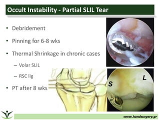 www.handsurgery.gr
Occult Instability - Partial SLIL Tear
• Debridement
• Pinning for 6-8 wks
• Thermal Shrinkage in chronic cases
– Volar SLIL
– RSC lig
• PT after 8 wks
 