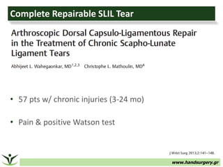 www.handsurgery.gr
Complete Repairable SLIL Tear
• 57 pts w/ chronic injuries (3-24 mo)
• Pain & positive Watson test
 