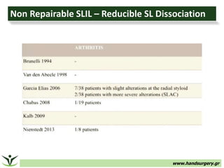 www.handsurgery.gr
Non Repairable SLIL – Reducible SL Dissociation
 