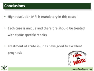 www.handsurgery.gr
• High resolution MRI is mandatory in this cases
• Each case is unique and therefore should be treated
with tissue specific repairs
• Treatment of acute injuries have good to excellent
prognosis
Conclusions
 