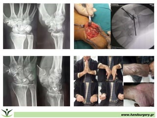 www.handsurgery.gr
 