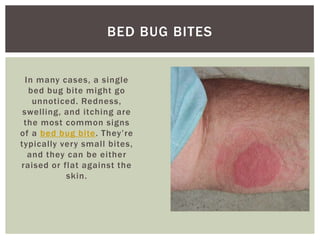 BED BUG BITES


  In many cases, a single
   bed bug bite might go
    unnoticed. Redness,
 swelling, and itching are
 the...